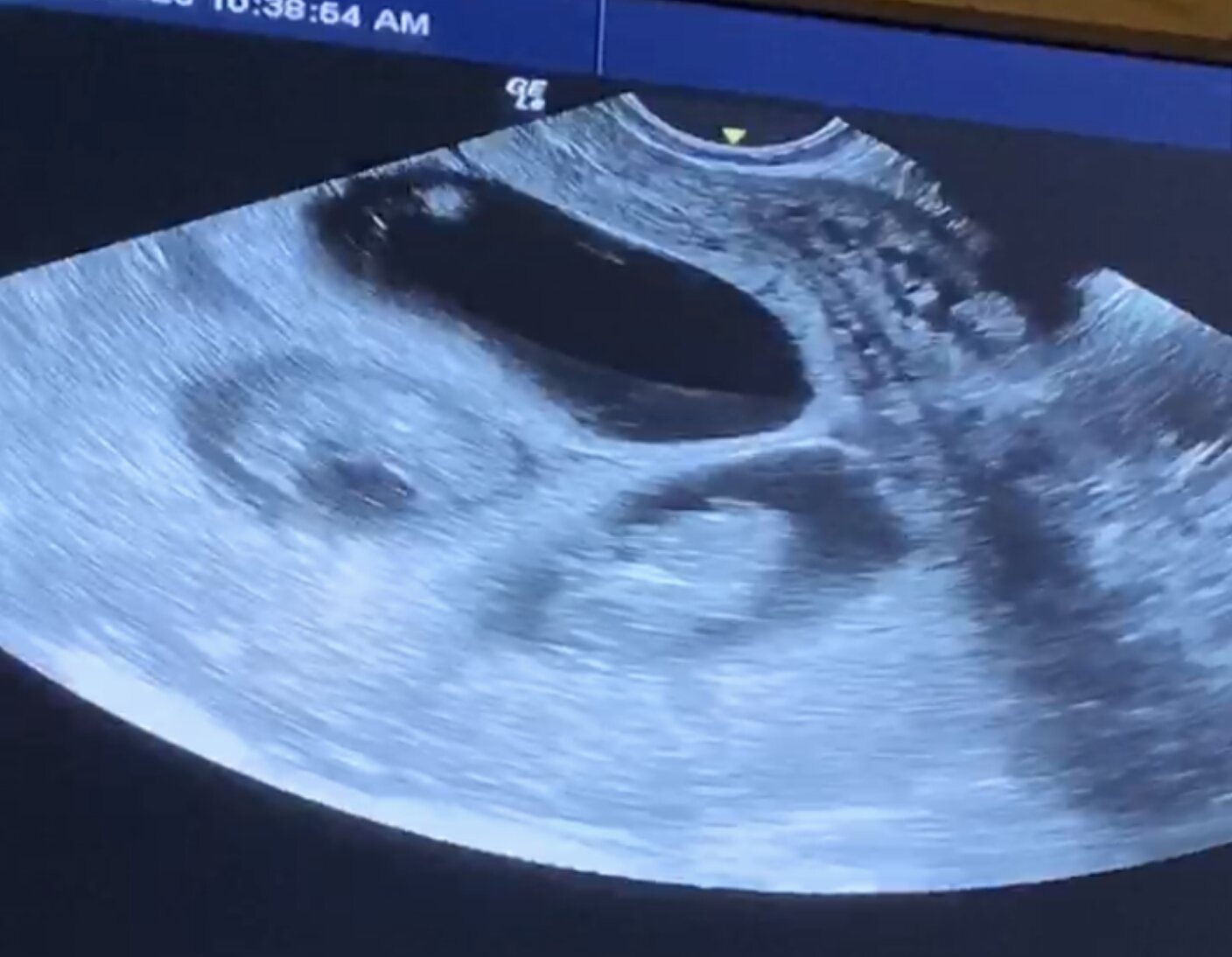 The Ultrasound